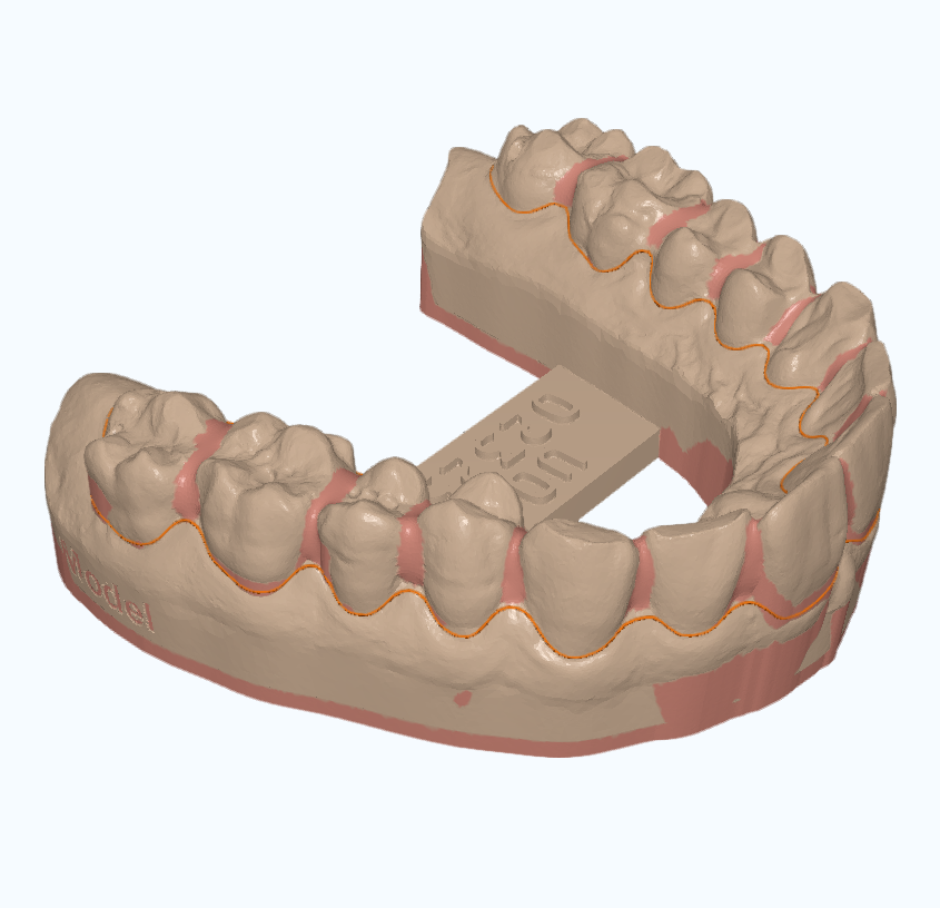 3D model of a based and ditched lower arch, ready to print