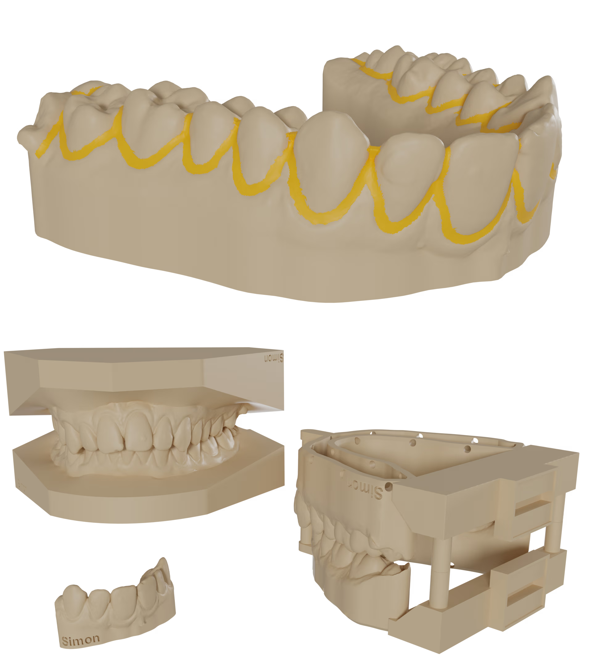 Retainer and ortho models.